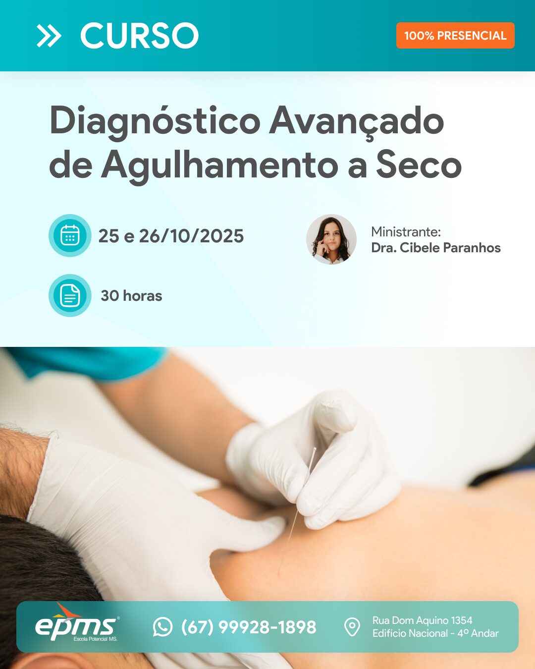 Curso de Diagnóstico Avançado de Agulhamento a Seco