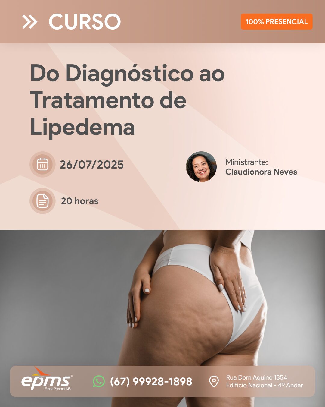 Curso do Diagnóstico ao Tratamento de Lipedema